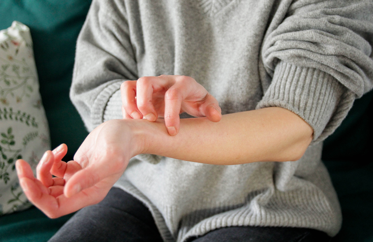 Photo shows person scratching arm